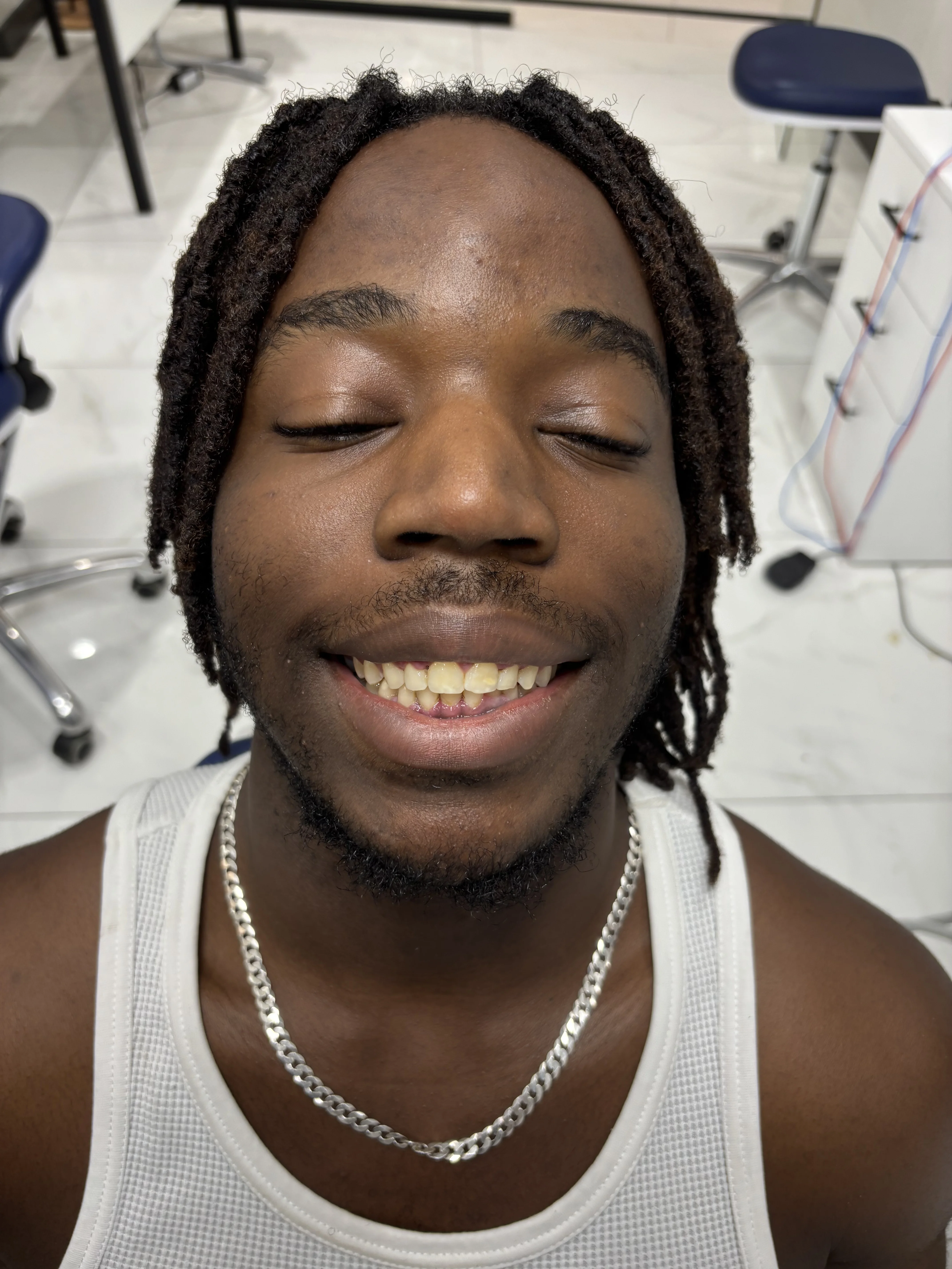 Before: severe atrophy, no teeth