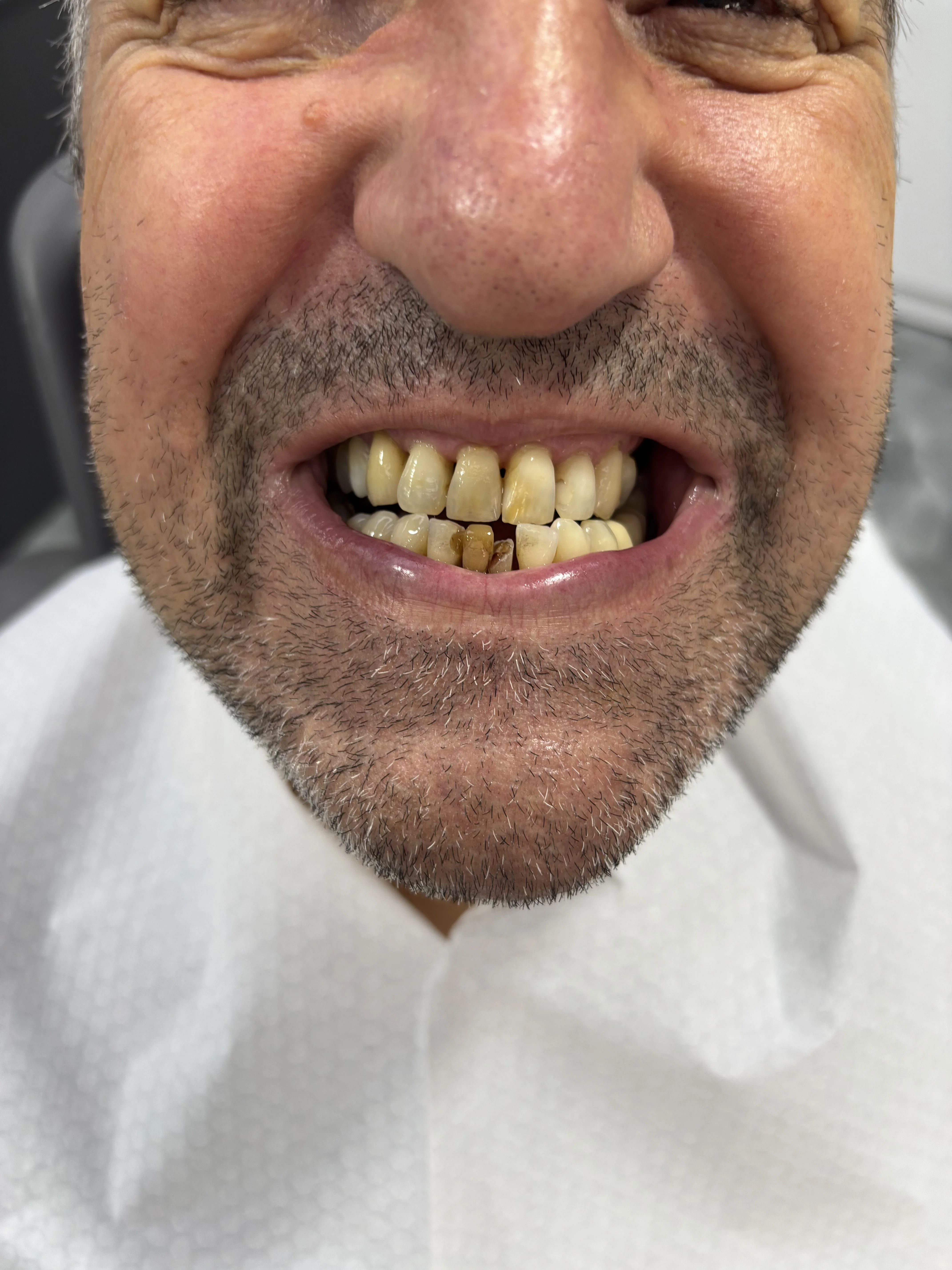Before: misaligned, aged appearance