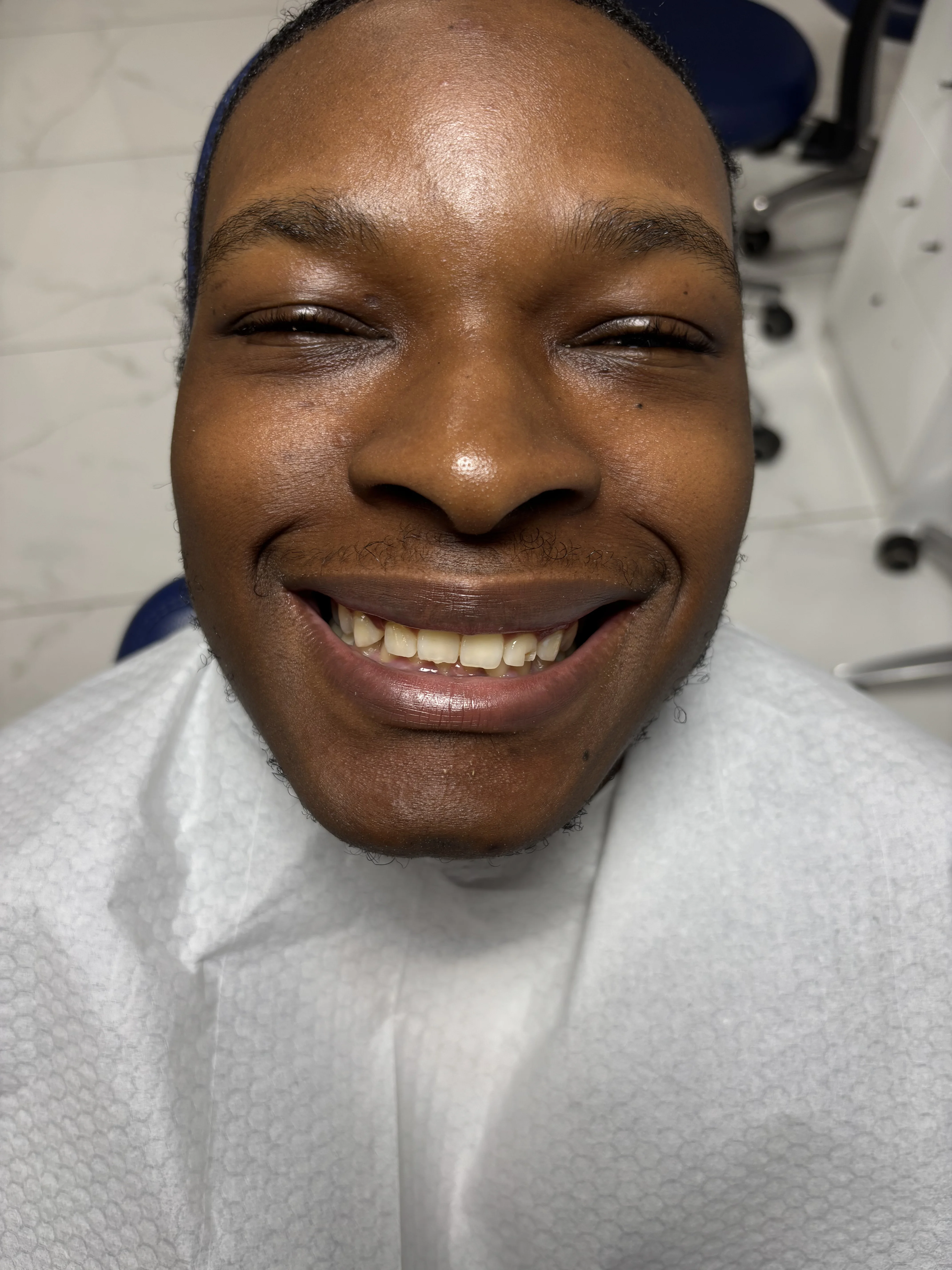 Before: complex aesthetic concerns